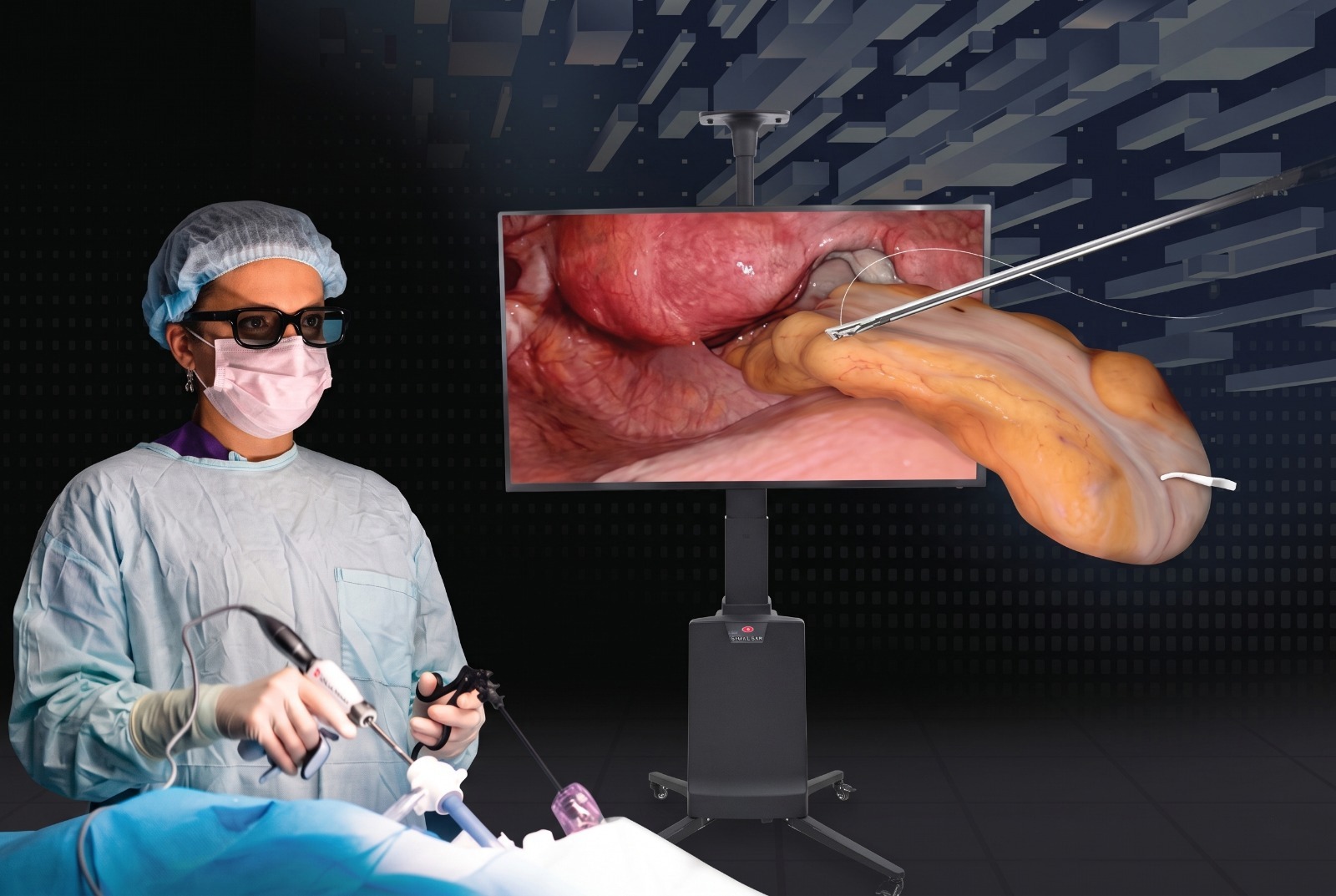 3D Laparoscopy System